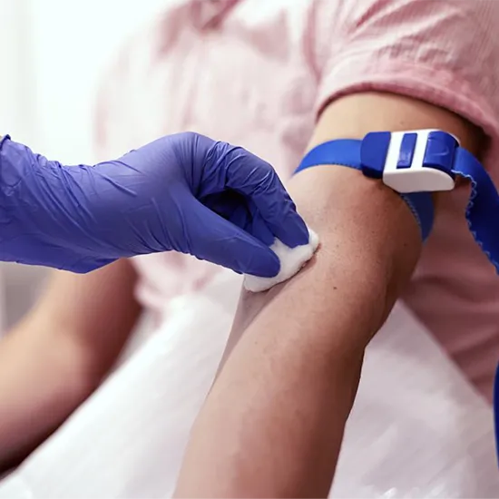 Blood Test for Protein S Test